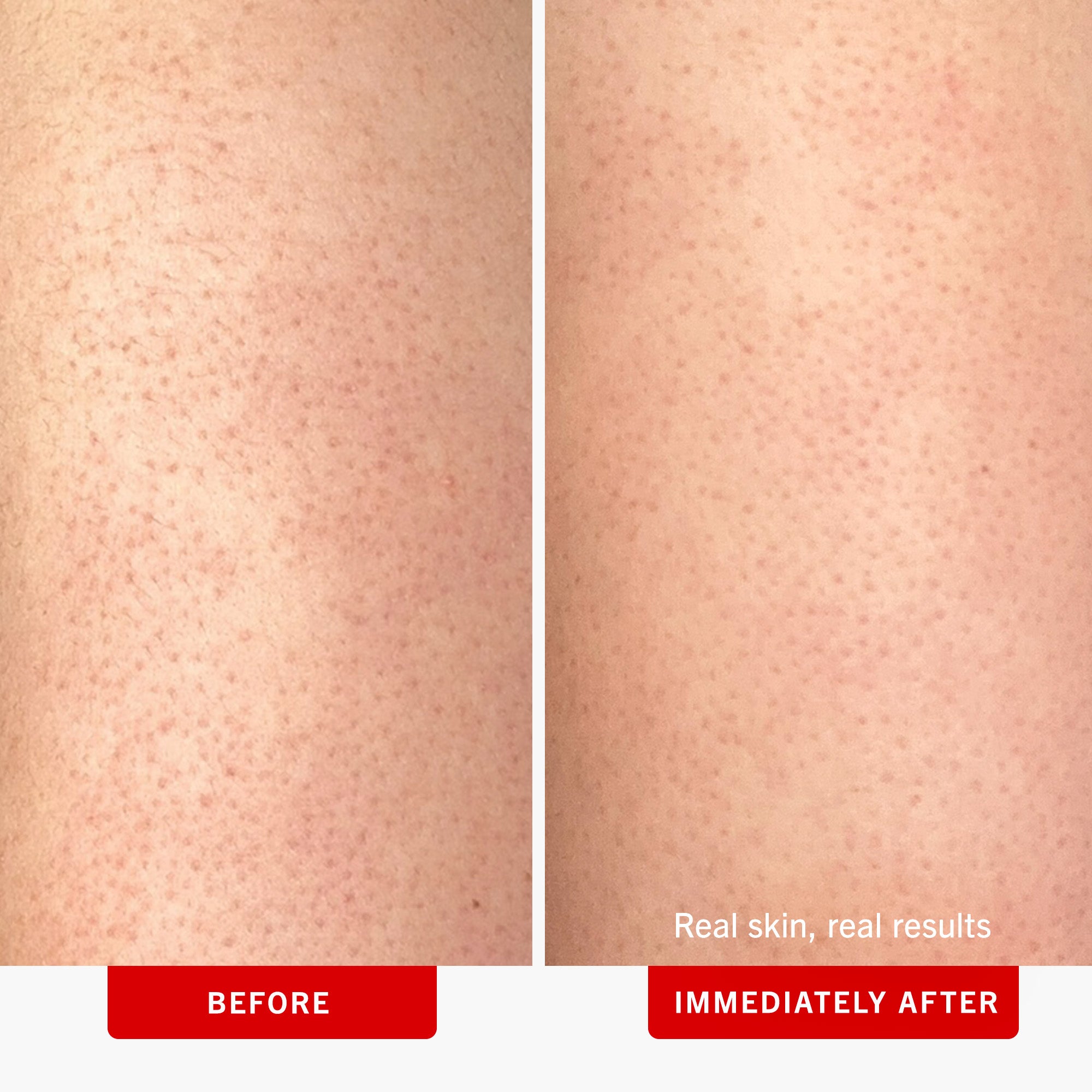 KP Bump Eraser Body Scrub