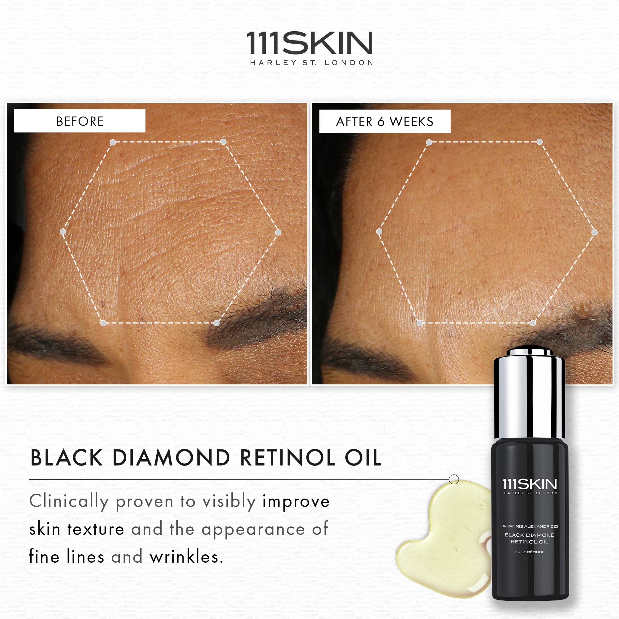 Black Diamond Retinol Oil | 30 ml