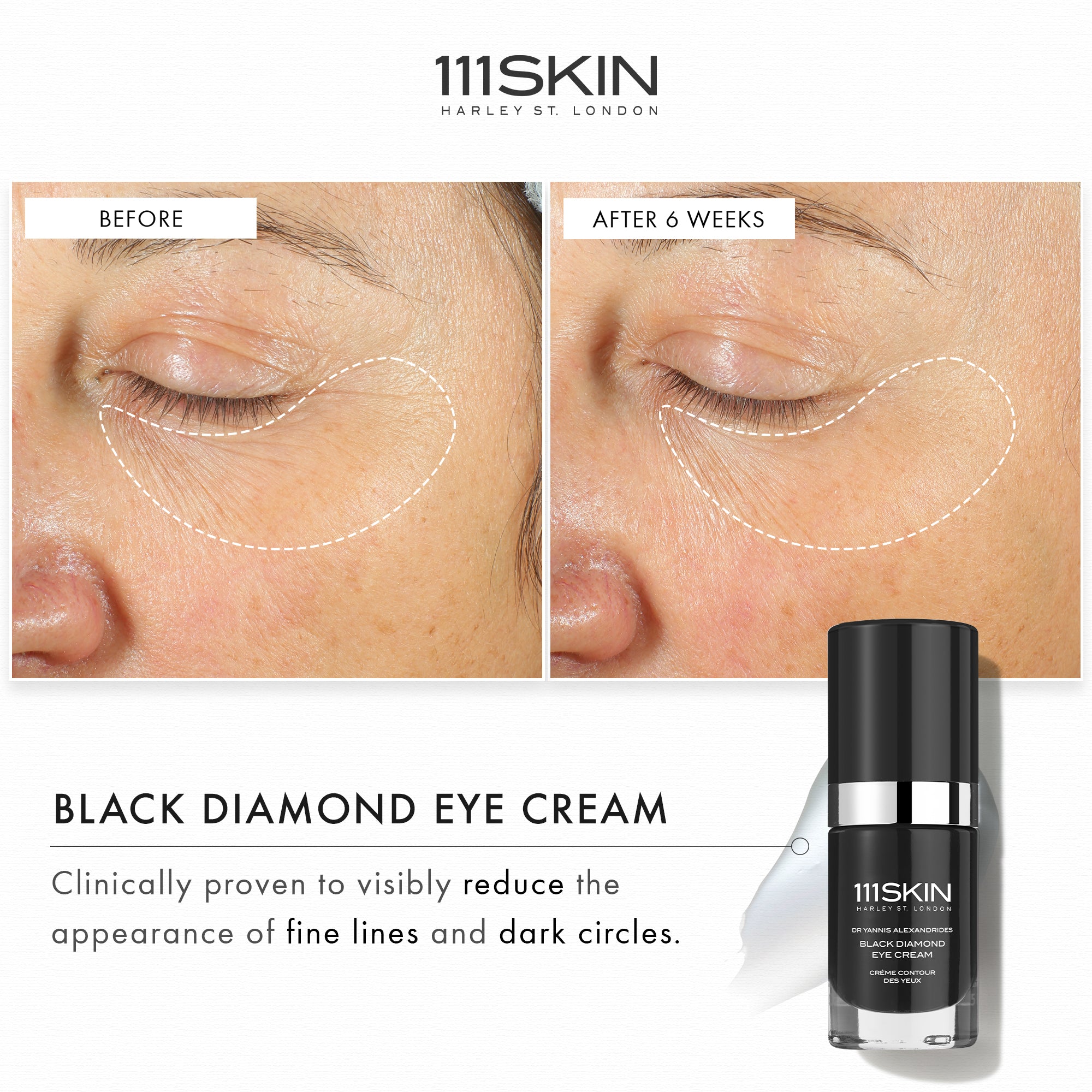 Precision Eye Lift Routine