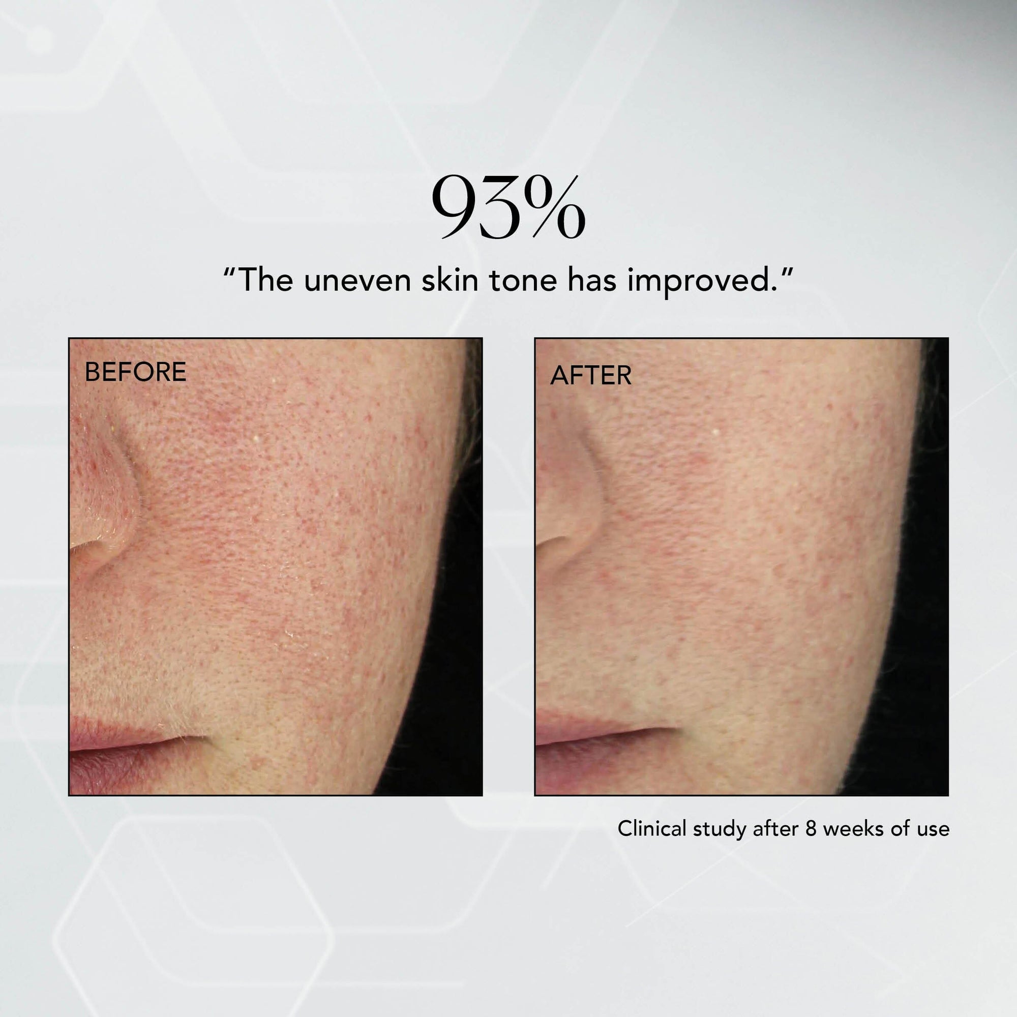 MD Advanced Hydration Crème MDSolarSciences™