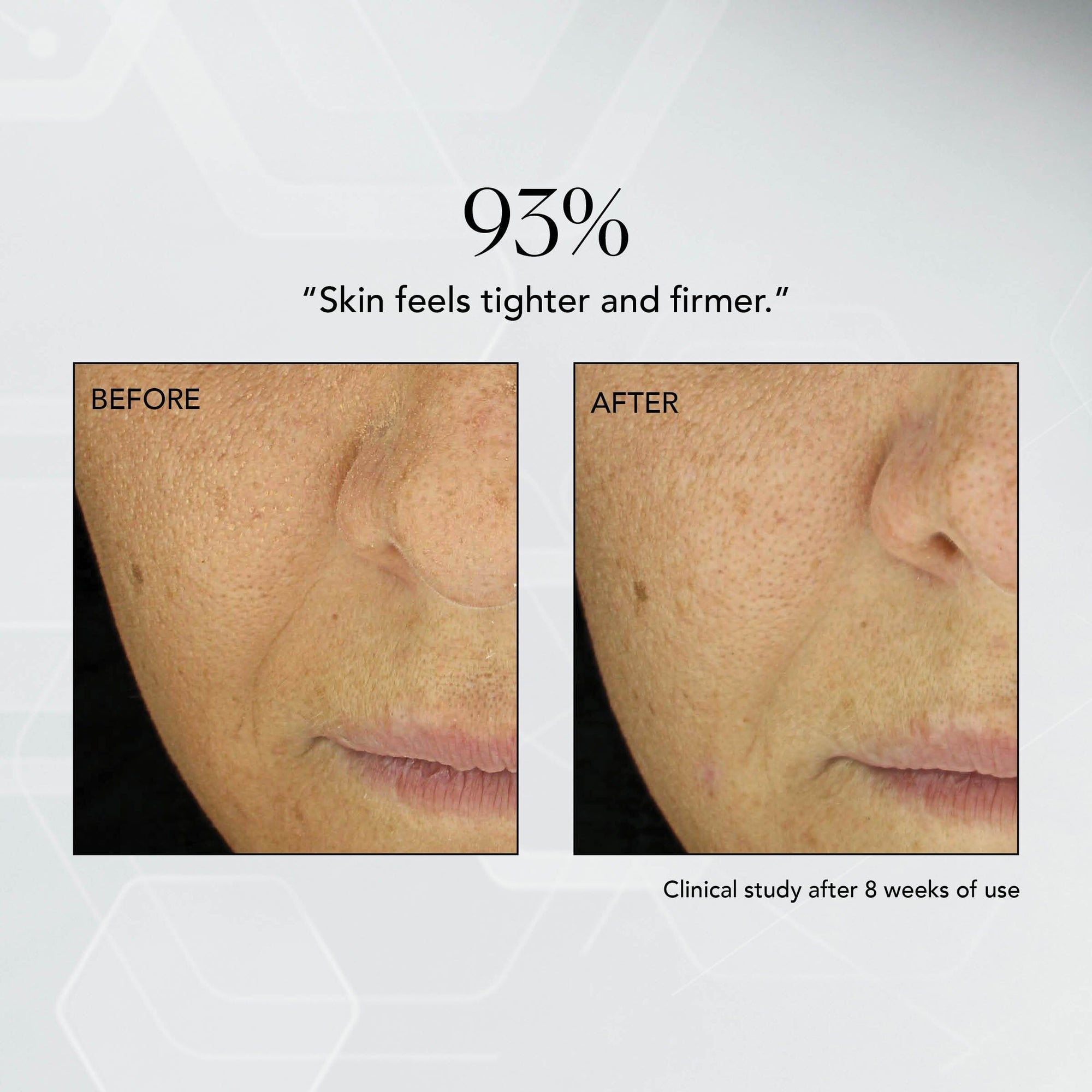 MD Advanced Hydration Crème MDSolarSciences™